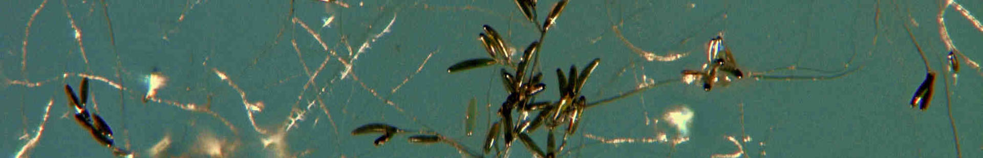 Bipolaris_yamadae_CMV007D9.jpg
